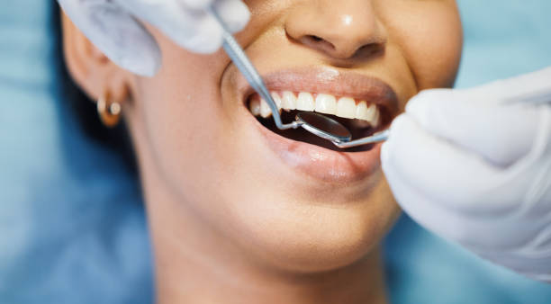 Best Knocked-Out Tooth Emergency  in Park City, MT