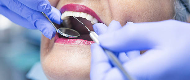 Best Broken Tooth Emergency  in Park City, MT